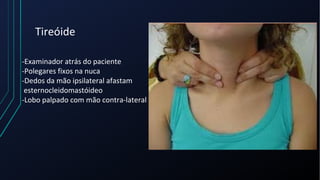 Tireóide
-Examinador atrás do paciente
-Polegares fixos na nuca
-Dedos da mão ipsilateral afastam
esternocleidomastóideo
-Lobo palpado com mão contra-lateral
 