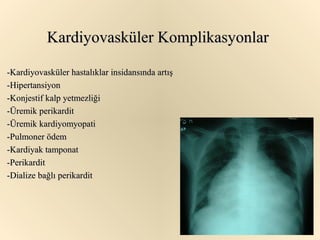 Kardiyovasküler Komplikasyonlar

-Kardiyovasküler hastalıklar insidansında artış
-Hipertansiyon
-Konjestif kalp yetmezliği
-Üremik perikardit
-Üremik kardiyomyopati
-Pulmoner ödem
-Kardiyak tamponat
-Perikardit
-Dialize bağlı perikardit
 