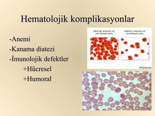 Hematolojik komplikasyonlar

-Anemi
-Kanama diatezi
-İmunolojik defektler
    +Hücresel
    +Humoral
 