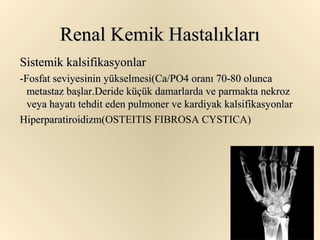 Renal Kemik Hastalıkları
Sistemik kalsifikasyonlar
-Fosfat seviyesinin yükselmesi(Ca/PO4 oranı 70-80 olunca
  metastaz başlar.Deride küçük damarlarda ve parmakta nekroz
  veya hayatı tehdit eden pulmoner ve kardiyak kalsifikasyonlar
Hiperparatiroidizm(OSTEITIS FIBROSA CYSTICA)
Hiperparatiroidizm(
 