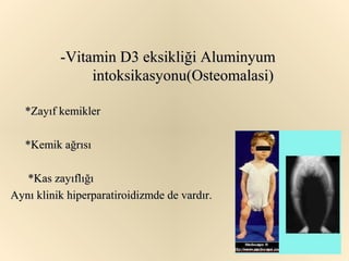 -Vitamin D3 eksikliği Aluminyum
               intoksikasyonu(Osteomalasi)

   *Zayıf kemikler

   *Kemik ağrısı

   *Kas zayıflığı
Aynı klinik hiperparatiroidizmde de vardır.
 