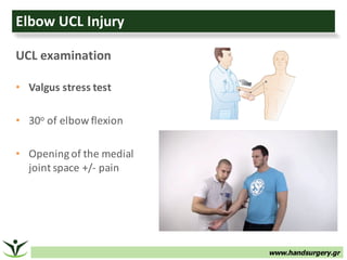 www.handsurgery.gr
Elbow	UCL	Injury
UCL	examination
• Valgus	stress	test	
• 30o of	elbow	flexion
• Opening	of	the	medial	
joint	space	+/- pain
 