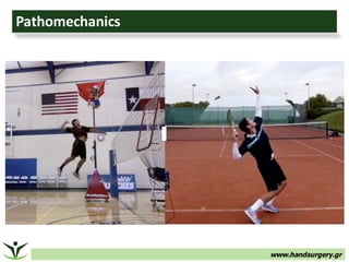 www.handsurgery.gr
Pathomechanics
 