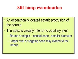 Slit lamp examination   An eccentrically located ectatic protrusion of the cornea  The apex is usually inferior to pupillary axis: Round or nipple – central cone , smaller diameter  Larger oval or sagging cone may extend to the limbus 
