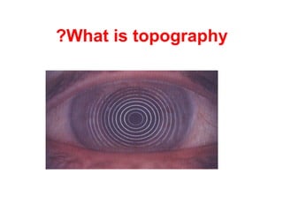 What is topography? 