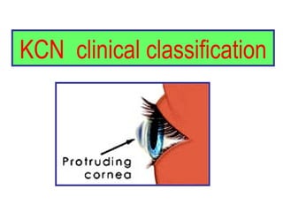 KCN  clinical classification 