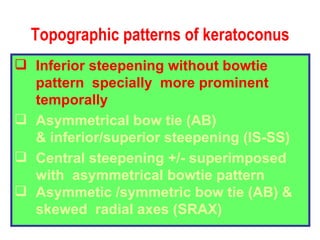 Topographic patterns of keratoconus Inferior steepening without bowtie pattern  specially  more prominent temporally Asymmetrical bow tie (AB) & inferior/superior steepening (IS-SS) Central steepening +/- superimposed with  asymmetrical bowtie pattern Asymmetic /symmetric bow tie (AB) &  skewed  radial axes (SRAX) 