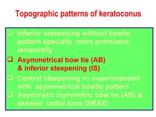 Topographic patterns of keratoconus Inferior steepening without bowtie pattern specially  more prominent temporally Asymmetrical bow tie (AB) & inferior steepening (IS) Central steepening +/- superimposed with  asymmetrical bowtie pattern Asymmetic /symmetric bow tie (AB) &  skewed  radial axes (SRAX) 
