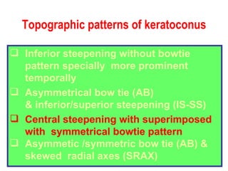 Topographic patterns of keratoconus Inferior steepening without bowtie pattern specially  more prominent temporally Asymmetrical bow tie (AB) & inferior/superior steepening (IS-SS) Central steepening with superimposed with  symmetrical bowtie pattern Asymmetic /symmetric bow tie (AB) &  skewed  radial axes (SRAX) 