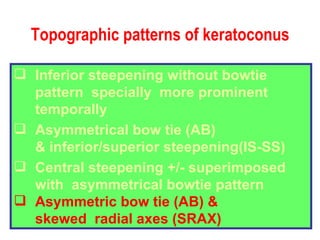 Topographic patterns of keratoconus Inferior steepening without bowtie pattern  specially  more prominent temporally Asymmetrical bow tie (AB) & inferior/superior steepening(IS-SS) Central steepening +/- superimposed with  asymmetrical bowtie pattern Asymmetric bow tie (AB) &  skewed  radial axes (SRAX) 