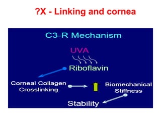 X - Linking and cornea? 