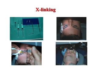 X-linking   