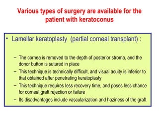 Various types of surgery are available for the patient with keratoconus Lamellar keratoplasty  (partial corneal transplant) : The cornea is removed to the depth of posterior stroma, and the donor button is sutured in place This technique is technically difficult, and visual acuity is inferior to that obtained after penetrating keratoplasty  This technique requires less recovery time, and poses less chance for corneal graft rejection or failure  Its disadvantages include vascularization and haziness of the graft   