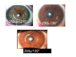 250    / 210° 250   / 90° 200  /120° 