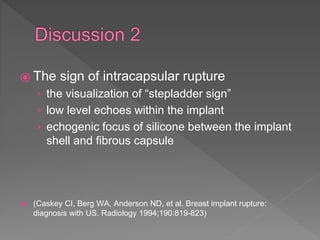 ⦿ The sign of intracapsular rupture
› the visualization of “stepladder sign”
› low level echoes within the implant
› echogenic focus of silicone between the implant
shell and fibrous capsule
⦿ (Caskey CI, Berg WA, Anderson ND, et al. Breast implant rupture:
diagnosis with US. Radiology 1994;190:819-823)
 