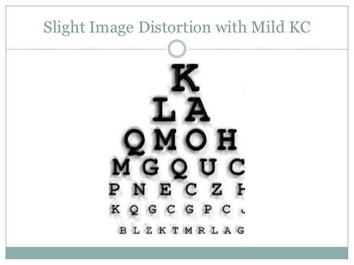 Keratoconus Through the Eyes of a Patient