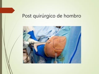 Post quirúrgico de hombro
 