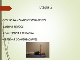 Etapa 2
-SEGUIR AVANZANDO EN ROM PASIVO
-LIBERAR TEJIDOS
-FISIOTERAPIA A DEMANDA
-OBSERVAR COMPENSACIONES
 