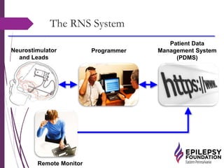 The RNS System
Neurostimulator
and Leads
Patient Data
Management System
(PDMS)
Programmer
Remote Monitor
 