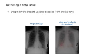 ● Deep network predicts various diseases from chest x-rays
Original image
Integrated gradients
(for top label)
Detecting a data issue
 