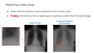 ● Deep network predicts various diseases from chest x-rays
● Finding: Attributions fell on radiologist’s markings (rather than the pathology)
Original image
Integrated gradients
(for top label)
Detecting a data issue
 