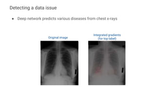 ● Deep network predicts various diseases from chest x-rays
Original image
Integrated gradients
(for top label)
Detecting a...