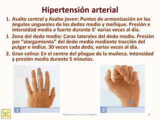 Hipertensión arterial
1. Asalto central y Asalto joven: Puntos de armonización en los
ángulos ungueales de los dedos medio y meñique. Presión e
intensidad media a fuerte durante 5’ varias veces al día.
1 Zona del dedo medio: Caras laterales del dedo medio. Presión
por “alargamiento” del dedo medio mediante tracción del
pulgar e índice. 30 veces cada dedo, varias veces al día.
2. Gran colina: En el centro del pliegue de la muñeca. Intensidad
y presión media durante 5 minutos.
18Digitopuntura, Dr.Franz Wagner
 