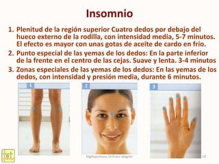 Insomnio
1. Plenitud de la región superior Cuatro dedos por debajo del
hueco externo de la rodilla, con intensidad media, 5-7 minutos.
El efecto es mayor con unas gotas de aceite de cardo en frío.
2. Punto especial de las yemas de los dedos: En la parte inferior
de la frente en el centro de las cejas. Suave y lenta. 3-4 minutos
3. Zonas especiales de las yemas de los dedos: En las yemas de los
dedos, con intensidad y presión media, durante 6 minutos.
19Digitopuntura, Dr.Franz Wagner
 