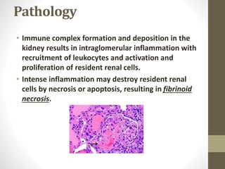 Pathology
• Immune complex formation and deposition in the
kidney results in intraglomerular inflammation with
recruitment of leukocytes and activation and
proliferation of resident renal cells.
• Intense inflammation may destroy resident renal
cells by necrosis or apoptosis, resulting in fibrinoid
necrosis.
 
