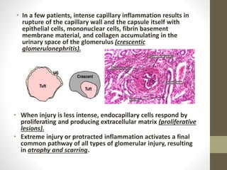 • In a few patients, intense capillary inflammation results in
rupture of the capillary wall and the capsule itself with
epithelial cells, mononuclear cells, fibrin basement
membrane material, and collagen accumulating in the
urinary space of the glomerulus (crescentic
glomerulonephritis).
• When injury is less intense, endocapillary cells respond by
proliferating and producing extracellular matrix (proliferative
lesions).
• Extreme injury or protracted inflammation activates a final
common pathway of all types of glomerular injury, resulting
in atrophy and scarring.
 