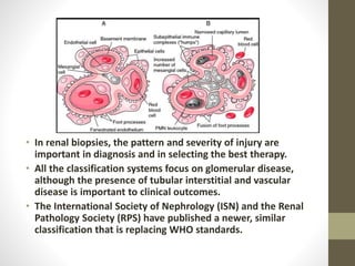 • In renal biopsies, the pattern and severity of injury are
important in diagnosis and in selecting the best therapy.
• All the classification systems focus on glomerular disease,
although the presence of tubular interstitial and vascular
disease is important to clinical outcomes.
• The International Society of Nephrology (ISN) and the Renal
Pathology Society (RPS) have published a newer, similar
classification that is replacing WHO standards.
 