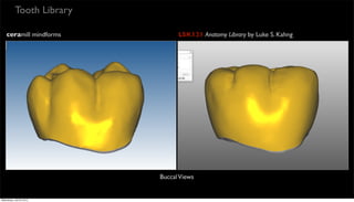 Tooth Library
ceramill mindforms LSK121 Anatomy Library by Luke S. Kahng
BuccalViews
Wednesday, July 29, 2015
 