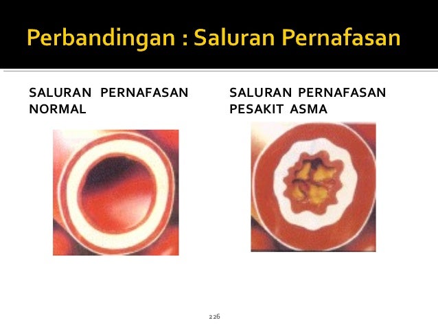 Kecederaan1 m1s2012