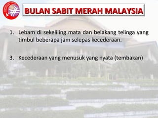Lebam di sekeliling mata dan belakang telinga yang timbul beberapa jam selepas kecederaan. Kecederaan yang menusuk yang nyata (tembakan) 