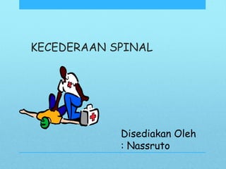 KECEDERAAN SPINAL
Disediakan Oleh
: Nassruto
 