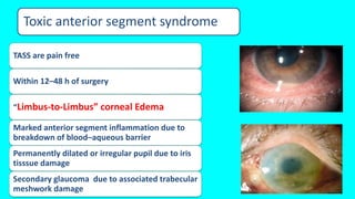 management of post cataract surgery corneal edema | PPTX