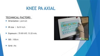 Knee radiographic positioning Keerthana knee[1].pptx