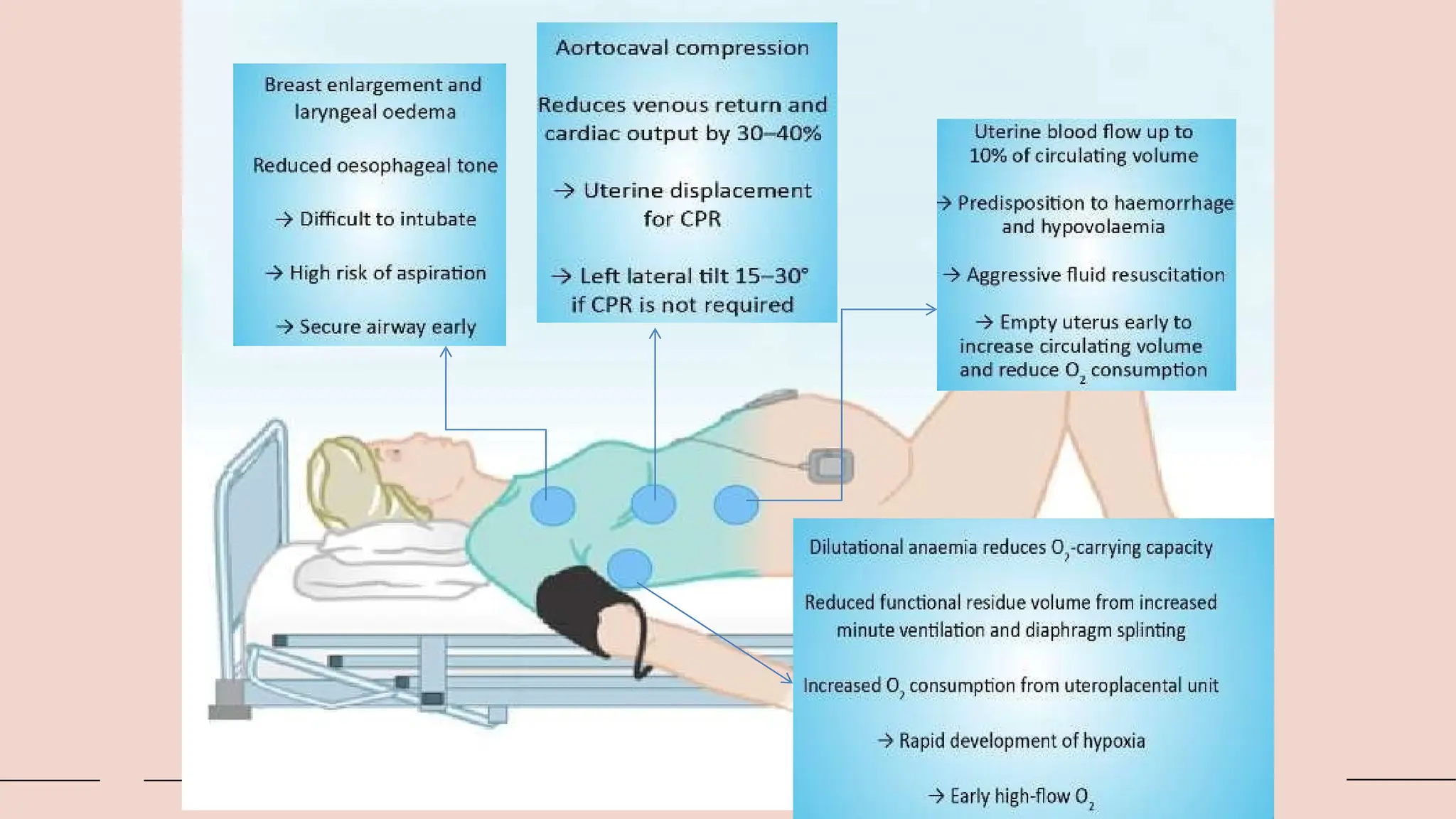Kegawatdaruratan maternal RJP ibu hamil.pptx