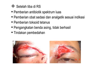  Setelah tiba di RS
 Pemberian antibiotik spektrum luas
 Pemberian obat sedasi dan analgetik sesuai indikasi
 Pemberian toksoid tetanus
 Pengangkatan benda asing, tidak berhasil
 Tindakan pembedahan

 