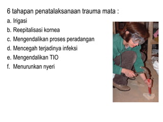 6 tahapan penatalaksanaan trauma mata :
a. Irigasi
b. Reepitalisasi kornea
c. Mengendalikan proses peradangan
d. Mencegah terjadinya infeksi
e. Mengendalikan TIO
f. Menurunkan nyeri

 