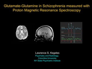 Glutamate-Glutamine in Schizophrenia measured with
     Proton Magnetic Resonance Spectroscopy




                  Lawrence S. Kegeles
                  Psychiatry and Radiology,
                     Columbia University
                 NY State Psychiatric Institute
 
