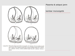 Plasenta & selaput janin
kembar monozigotik
 
