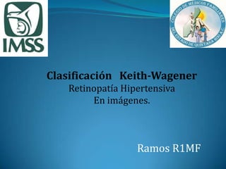 Clasificación   Keith-Wagener Retinopatía Hipertensiva En imágenes. Ramos R1MF 