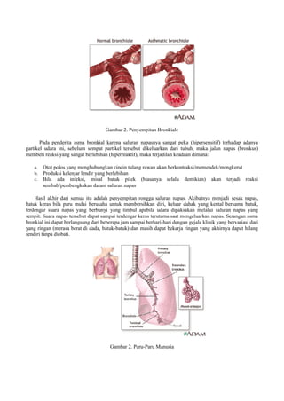 Gambar 2. Penyempitan Bronkiale
Pada penderita asma bronkial karena saluran napasnya sangat peka (hipersensitif) terhadap adanya
partikel udara ini, sebelum sempat partikel tersebut dikeluarkan dari tubuh, maka jalan napas (bronkus)
memberi reaksi yang sangat berlebihan (hiperreaktif), maka terjadilah keadaan dimana:
a. Otot polos yang menghubungkan cincin tulang rawan akan berkontraksi/memendek/mengkerut
b. Produksi kelenjar lendir yang berlebihan
c. Bila ada infeksi, misal batuk pilek (biasanya selalu demikian) akan terjadi reaksi
sembab/pembengkakan dalam saluran napas
Hasil akhir dari semua itu adalah penyempitan rongga saluran napas. Akibatnya menjadi sesak napas,
batuk keras bila paru mulai berusaha untuk membersihkan diri, keluar dahak yang kental bersama batuk,
terdengar suara napas yang berbunyi yang timbul apabila udara dipaksakan melalui saluran napas yang
sempit. Suara napas tersebut dapat sampai terdengar keras terutama saat mengeluarkan napas. Serangan asma
bronkial ini dapat berlangsung dari beberapa jam sampai berhari-hari dengan gejala klinik yang bervariasi dari
yang ringan (merasa berat di dada, batuk-batuk) dan masih dapat bekerja ringan yang akhirnya dapat hilang
sendiri tanpa diobati.
Gambar 2. Paru-Paru Manusia
 