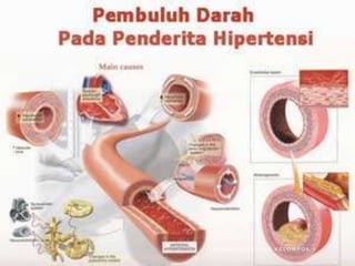 K A R D I O V A S K U L A R K E L O M P O K 1
 