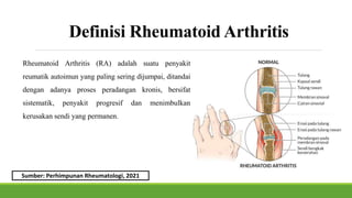 KEL 4 RHEUMATOID ARTHRITIS.pptx