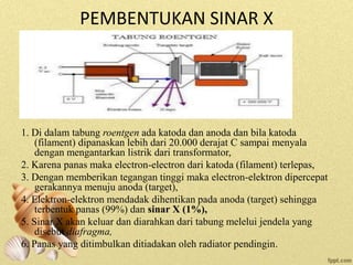 PEMBENTUKAN SINAR X
1. Di dalam tabung roentgen ada katoda dan anoda dan bila katoda
(filament) dipanaskan lebih dari 20.000 derajat C sampai menyala
dengan mengantarkan listrik dari transformator,
2. Karena panas maka electron-electron dari katoda (filament) terlepas,
3. Dengan memberikan tegangan tinggi maka electron-elektron dipercepat
gerakannya menuju anoda (target),
4. Elektron-elektron mendadak dihentikan pada anoda (target) sehingga
terbentuk panas (99%) dan sinar X (1%),
5. Sinar X akan keluar dan diarahkan dari tabung melelui jendela yang
disebut diafragma,
6. Panas yang ditimbulkan ditiadakan oleh radiator pendingin.
 