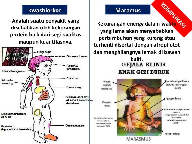Kelainan kelainan metabolise tubuh