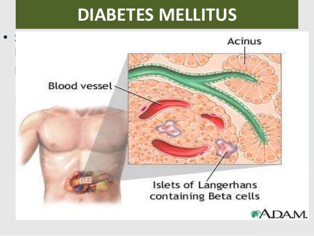 Kelainan kelainan metabolise tubuh