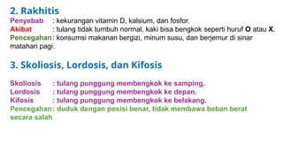 Kaki Rakhitis Kelainan dan Penyakit pada Alat Gerak Manusia.pptx